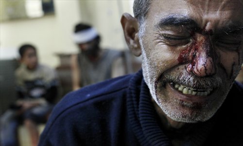 Kamal, the father of an eight-year-old girl who was fatally wounded along with his son Hamed (sitting at left on background), cries while being treated in a local hospital in a rebel-controlled area of Aleppo, on Wednesday. Photo: AFP