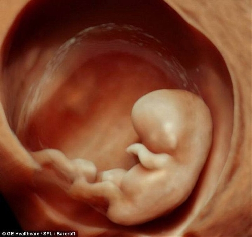 The incredible 3D scans allow parents to see foetus smiling and moving in stunning detail. (Photo Source: tech.qq.com)