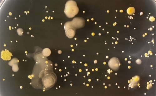 A recent study by Professor Simon Park at Surrey University in UK showed that your cellphone contains a lots of bacteria and germs. Here are some pictures. (Photo Source: forum.news.cn)