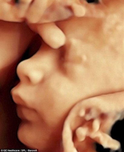 The incredible 3D scans allow parents to see foetus smiling and moving in stunning detail. (Photo Source: tech.qq.com)