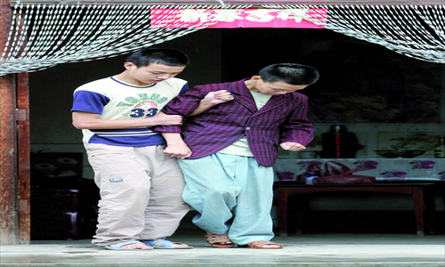 Left: a young patient struggles to take care of himself. Right: an operation can help people with the disease. Photos: CFP 1