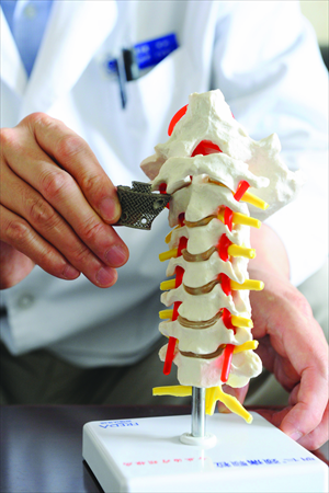 Professor Liu Zhongjun shows a printed metal implant for the cervical vertebrae. Photo: Li Hao/ GT