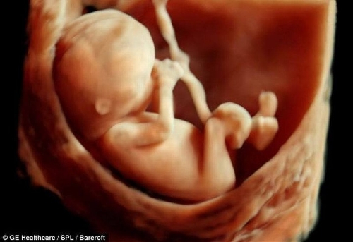 The incredible 3D scans allow parents to see foetus smiling and moving in stunning detail. (Photo Source: tech.qq.com)