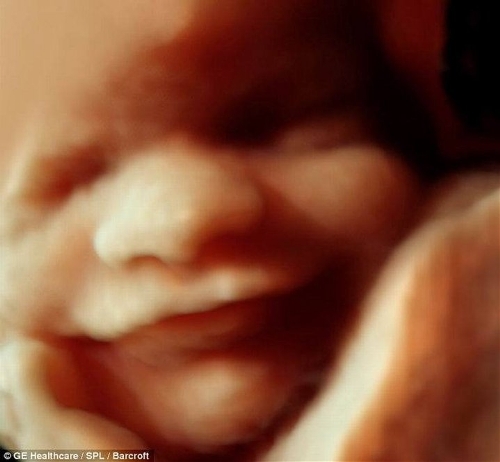 The incredible 3D scans allow parents to see foetus smiling and moving in stunning detail. (Photo Source: tech.qq.com)