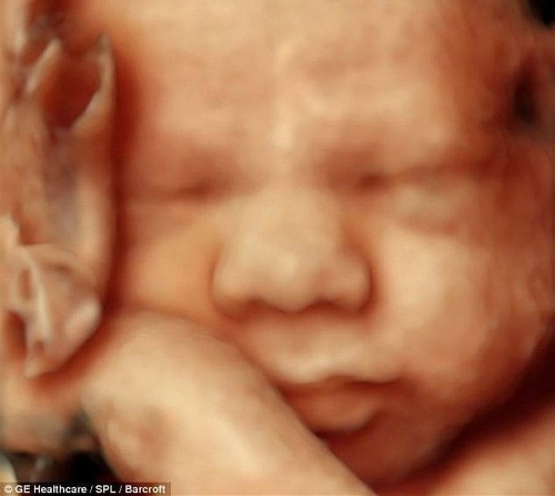 The incredible 3D scans allow parents to see foetus smiling and moving in stunning detail. (Photo Source: tech.qq.com)