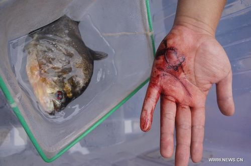 Photo taken on July 7, 2012 show wounds on the palm of a citizen casued by the sharp teeth of the piranha in Liuzhou, South China's Guangxi Zhuang Autonomous Region. Recently, two people were bitten in the Liujiang River by piranhas originating from South America. The number of piranhas in the Liujiang River is under investigation and relevant departments will soon take corresponding measures. Photo: Xinhua