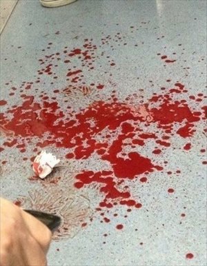 The blood at Tuanjiehu subway station on December 12. Photo: weibo.com