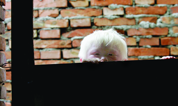 An albino child adopted by Yuan Lihai, a serial foster mother in Lankao, Henan Province, peeps out from a window. Photo: CFP