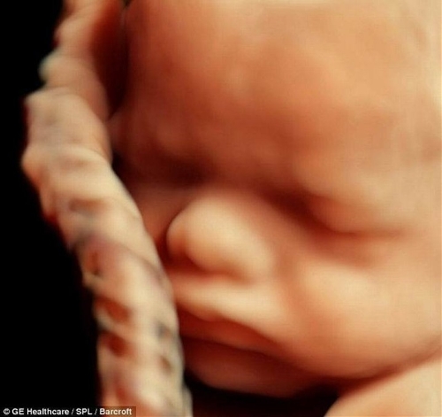 The incredible 3D scans allow parents to see foetus smiling and moving in stunning detail. (Photo Source: tech.qq.com)