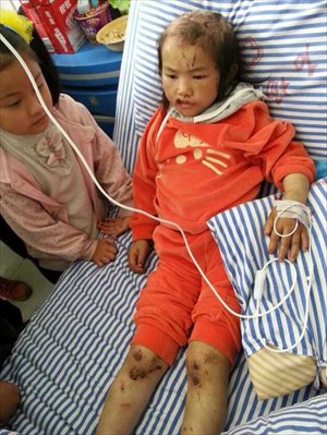 After being rescued from her abusive father, Yang Xin (pseudonym), 11, was relocated to a local hospital for medical treatment. Photo: Courtesy of Wang Jie