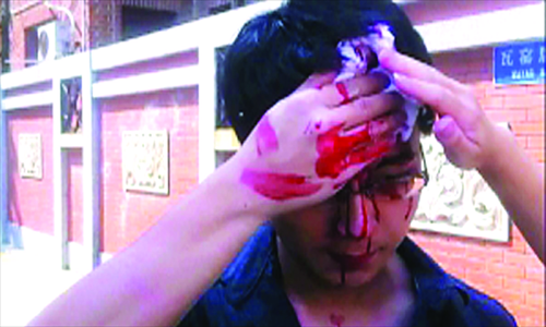 Lu Yaoyao, a reporter from Nanyang TV, attempts to stop his bleeding after being attacked by two men while investigating an unlicensed parking lot in Guangzhou on October 19, 2011. Photo: IC