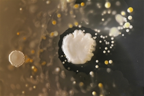 A recent study by Professor Simon Park at Surrey University in UK showed that your cellphone contains a lots of bacteria and germs. Here are some pictures.(Photo Source: forum.news.cn)