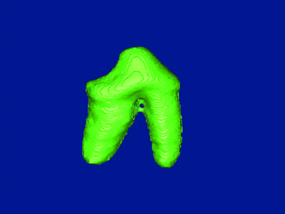 A computer-generated model of a tooth. Photo:Courtesy of Tang Zhihui