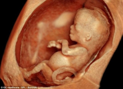 The incredible 3D scans allow parents to see foetus smiling and moving in stunning detail. (Photo Source: tech.qq.com)