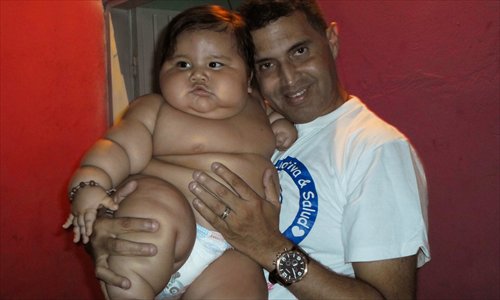middelen Sympton Tub 20-kilo 8-month-old put on urgent diet - Global Times
