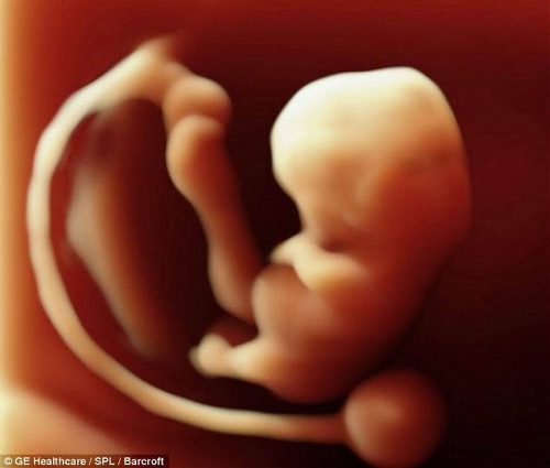 The incredible 3D scans allow parents to see foetus smiling and moving in stunning detail. (Photo Source: tech.qq.com)