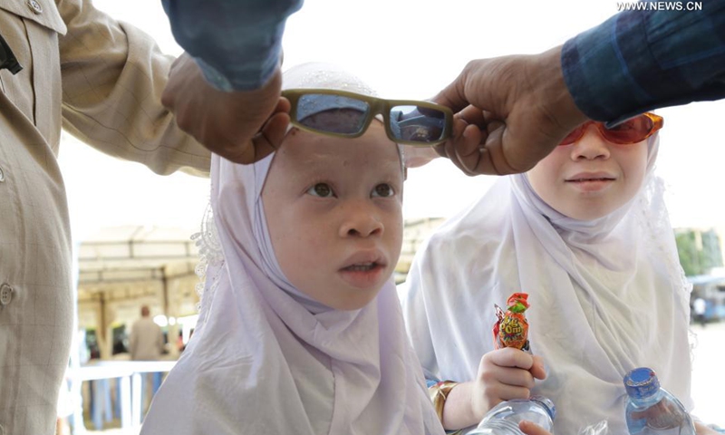 A kid suffering from albinism receives eye examination at an event to mark the International Albinism Awareness Day in Dar es Salaam, Tanzania, June 13, 2021. The government of Tanzania on Sunday pledged full protection of people with albinism by reinforcing their security. International Albinism Awareness Day is celebrated annually on June 13. The theme of the day this year is Strength Beyond All Odds.(Photo: Xinhua)