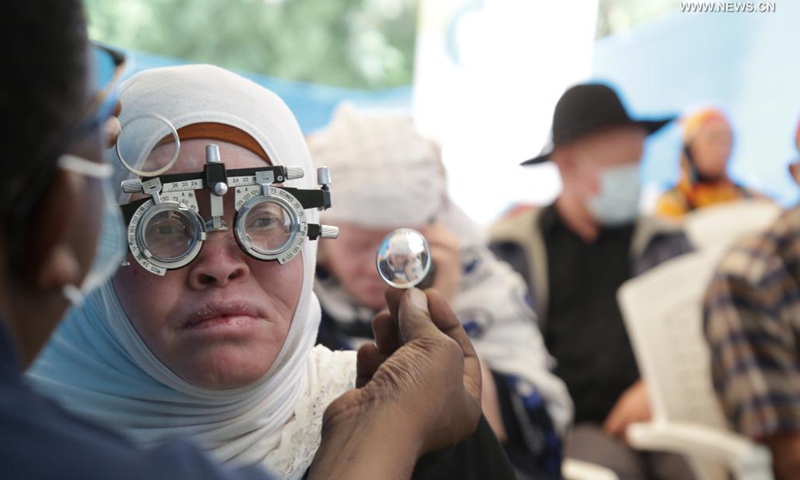 A woman suffering from albinism receives eye examination at an event to mark the International Albinism Awareness Day in Dar es Salaam, Tanzania, June 13, 2021. The government of Tanzania on Sunday pledged full protection of people with albinism by reinforcing their security. International Albinism Awareness Day is celebrated annually on June 13. The theme of the day this year is Strength Beyond All Odds.(Photo: Xinhua)