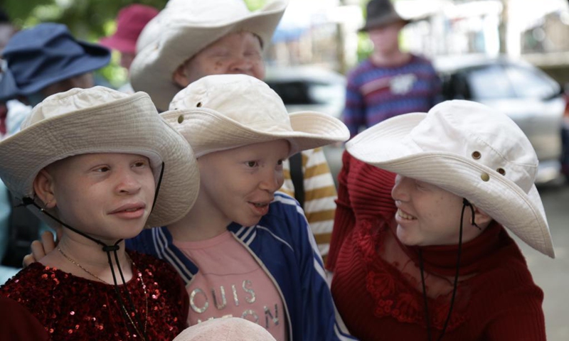 People suffering from albinism gather at an event to mark the International Albinism Awareness Day in Dar es Salaam, Tanzania, June 13, 2021. The government of Tanzania on Sunday pledged full protection of people with albinism by reinforcing their security. International Albinism Awareness Day is celebrated annually on June 13. The theme of the day this year is Strength Beyond All Odds.(Photo: Xinhua)