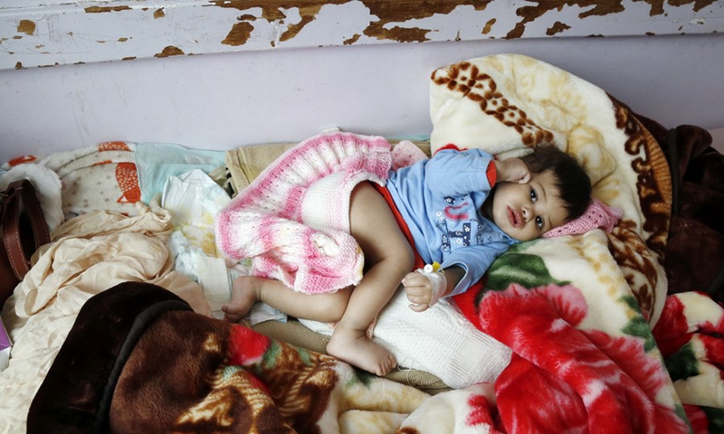 A malnourished child lies on the bed, waiting for his treatment, at a hospital in Sanaa, Yemen on July 31, 2021.(Photo: Xinhua)