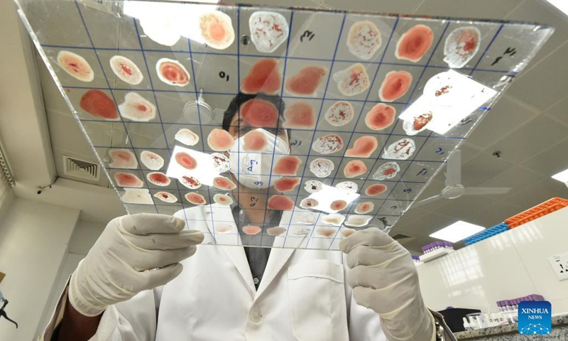 A technician processes blood samples at a blood bank in a hospital in Dhaka, Bangladesh, Sept. 16, 2021. Bangladesh saw a significant spike in dengue fever cases over recent months, with 15,976 cases and 59 deaths from the mosquito-borne tropical disease registered so far this year, according to the country's Directorate General of Health Services (DGHS) on Monday.(Photo: Xinhua)