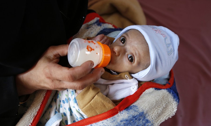 A mother feeds her malnourished child at Al-Sabeen hospital in Sanaa, Yemen, Oct. 21, 2020. Some 20 million people in Yemen are food insecure, including nearly 10 million people in acute food insecurity.(Photo: Xinhua)