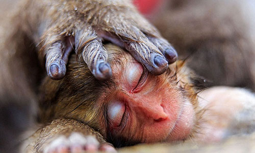 新疆中医医院鼻出血