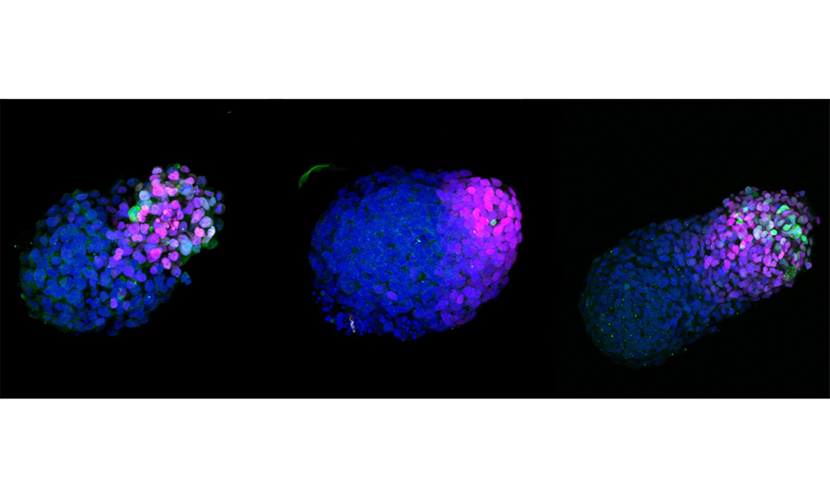 A combination of scans of a growing human gastruloid (L/R) 24hours/48hours and 72 hours. Scientists have developed a human embryo blueprint using human stem cells, in a breakthrough that could provide vital insight into the early stages of infant development, new research showed June 11, 2020. Photo: VCG