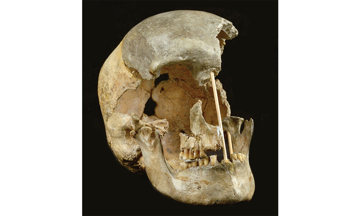 The skull of a modern human female individual from Zlaty kun on April 7, 2021. Genetic sequencing of human remains dating back 45,000 years has revealed a previously unknown migration into Europe and showed intermixing with Neanderthals in that period was more common than previously thought. Photo: VCG