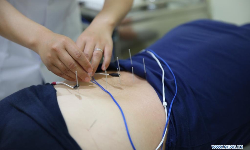 A patient receives acupuncture treatment at the Mediterranean Regional Center for Traditional Chinese Medicine (MRCTCM) in Paola, Malta, April 27, 2021. The MRCTCM was officially established in 1994 as a partnership between the Chinese and Maltese governments.(Photo: Xinhua)