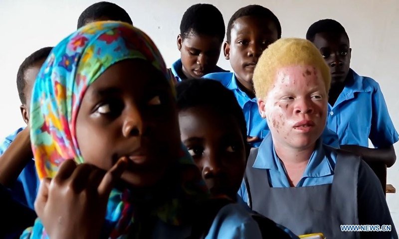 A child with albinism (2nd R) attends class in Machinga, Malawi, June 11, 2021.Photo: Xinhua