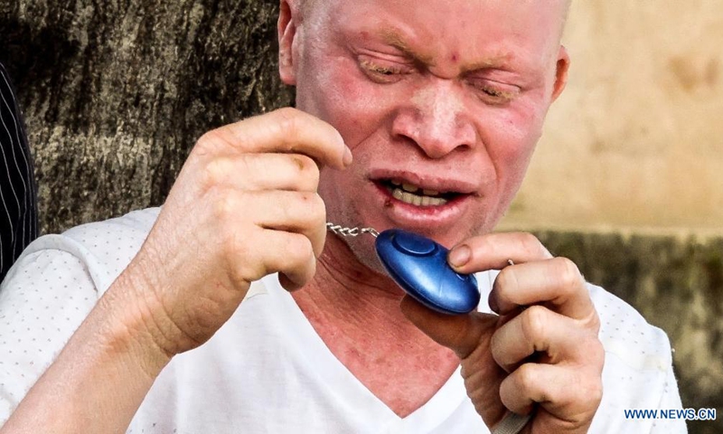 A person with albinism holds a personal security alarm in Machinga, Malawi, June 11, 2021.Photo: Xinhua
