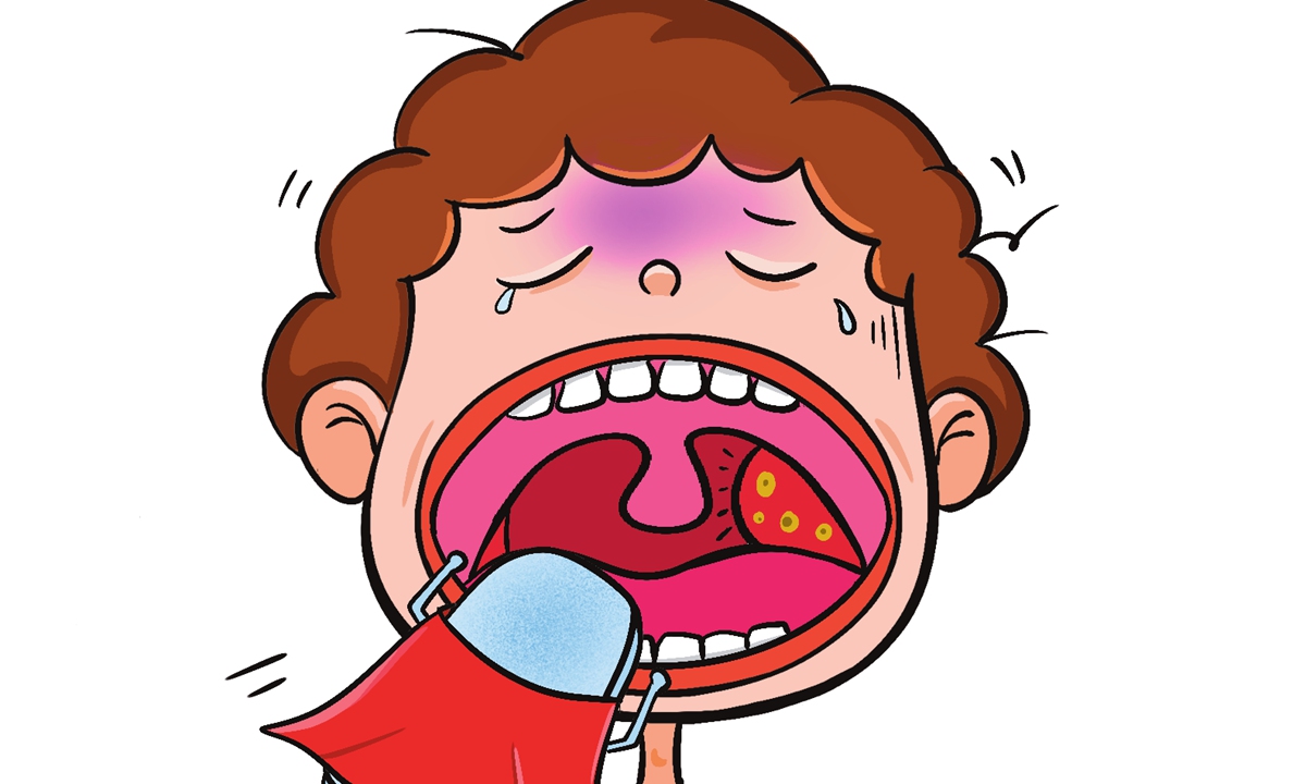 Illustration: Liu Xidan/GT 