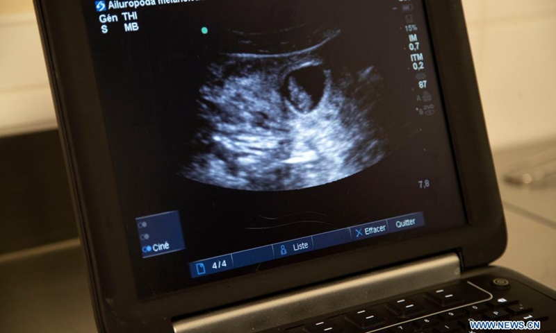 An embryo of giant panda Huan Huan is detected on ultrasound at the Beauval Zoo in Saint-Aignan-sur-Cher, France, July 20, 2021. Huan Huan, a giant panda at Beauval Zoo in central France, is pregnant and the birth of her cub is expected in about 10 days, announced the zoo.Photo:Xinhua