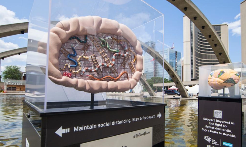 Brain sculptures are seen at the Brain Project art exhibition in Nathan Phillips Square Pond in Toronto, Canada, on July 21, 2021.Photo:Xinhua