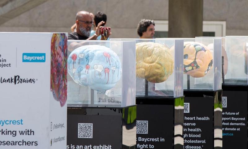 People look at brain sculptures at the Brain Project art exhibition in Nathan Phillips Square Pond in Toronto, Canada, on July 21, 2021.Photo:Xinhua