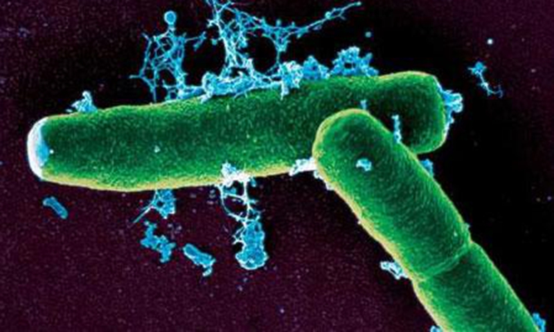 Bacillus anthracis, the pathogen that causes anthrax  Photo: website of Chinese Center for Disease Control and Prevention 