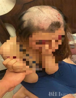 A video, which shows a woman's hair has been shaved causing blood to come out on her head, has circulated online since Monday. Photo: screenshot of video from local media outlet