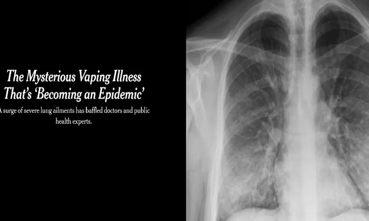 Report on Vaping Illness by New York Times in September, 2019  Photo: Screenshot on NYT