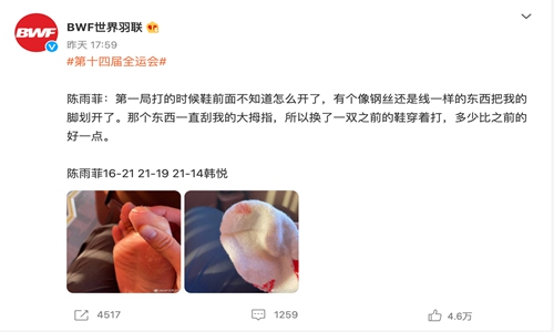A screenshot of Badminton World Federation's Sina Weibo post about badminton player Chen Yufei's injury
