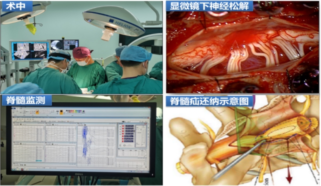 Intraoperative scene 