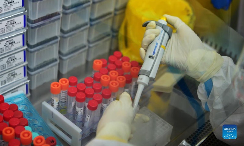 A staff member deals with nucleic acid testing samples in a PCR (polymerase chain reaction) lab in Xianyou County, southeast China's Fujian Province, Sept. 14, 2021. Three PCR labs have been built in the county to boost nucleic acid detection capacity.Photo:Xinhua