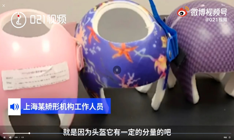 Appearance-anxious parents correct baby head shapes with helmets. Photo: screenshot of 021 Video on Sina Weibo. 