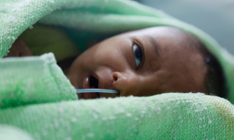 An acutely malnourished child lies on a bed in the al-Thawrah hospital in Hodeidah, the Red Sea port city of Yemen, Nov. 20, 2021.Photo:Xinhua