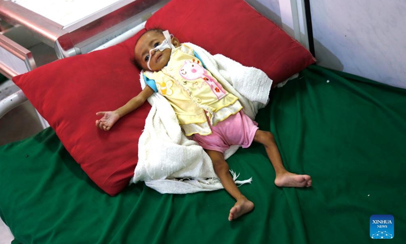 An acutely malnourished child lies on a bed in the al-Thawrah hospital in Hodeidah, the Red Sea port city of Yemen, Nov. 20, 2021.Photo:Xinhua