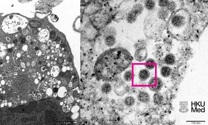HKUMed reveals the electron microscope image of SARS-CoV-2 Omicron variant. Photo: HKUMed 