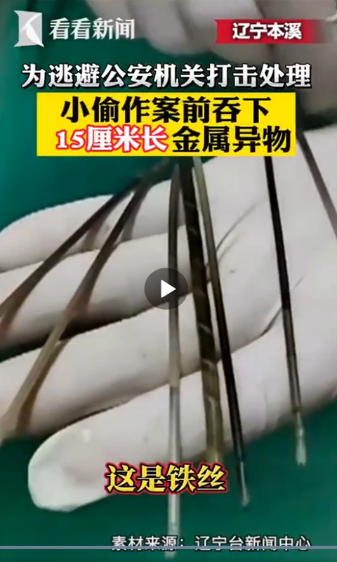 A thief in Benxi, Northeast China's Liaoning Province, swallowed nails and iron wires as long as 15 centimeters before stealing in the hope of escaping police penalties. Photo: screenshot of KNews on Sina Weibo.