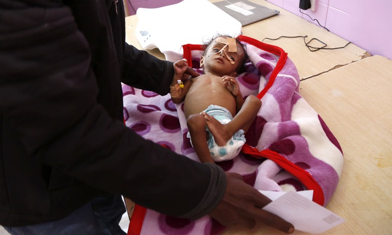 A father brings his malnourished child to be weighed as he receives medical treatment at the malnutrition treating ward in a hospital in Sanaa, Yemen, on March 13, 2022.(Photo: Xinhua)