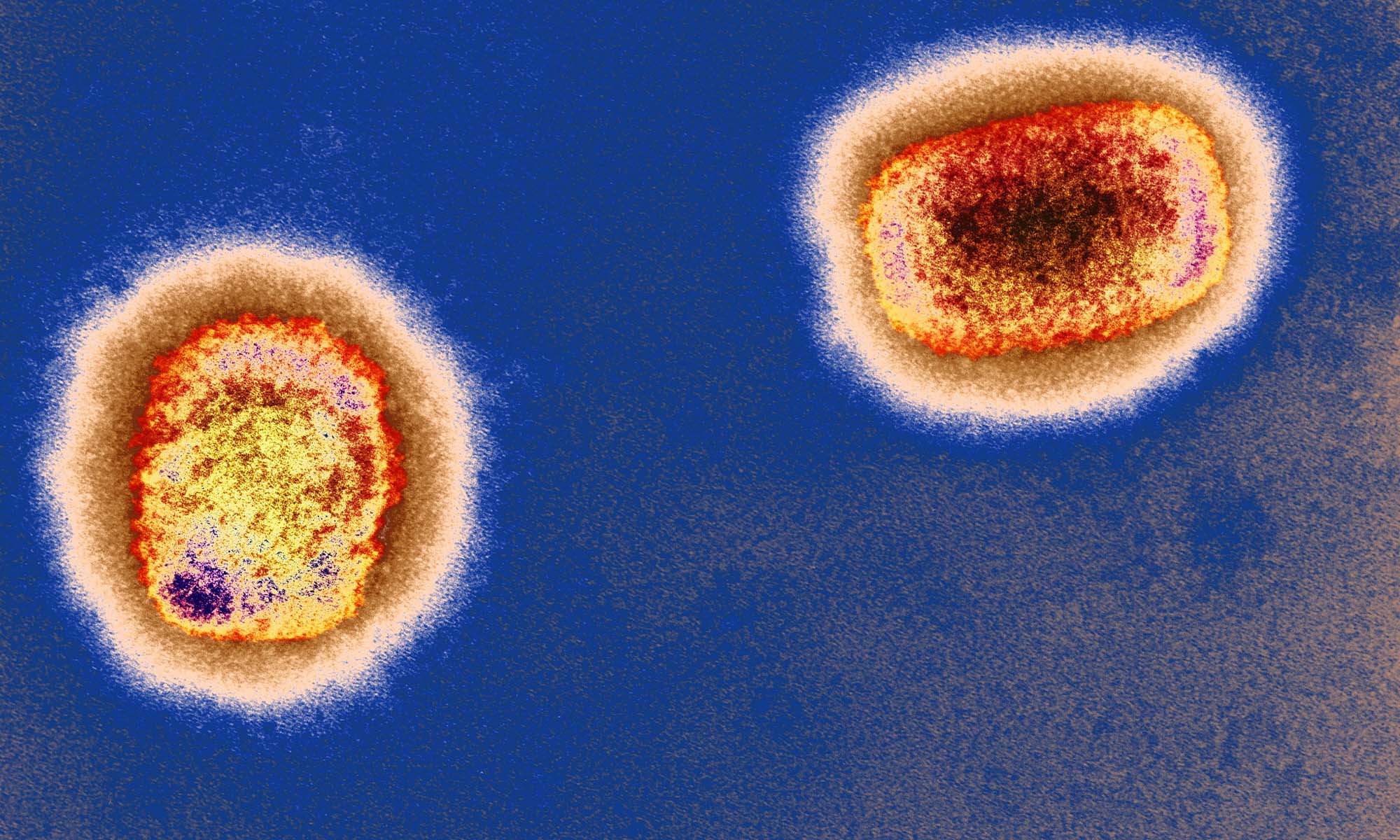 The monkeypox virus Photo:VCG