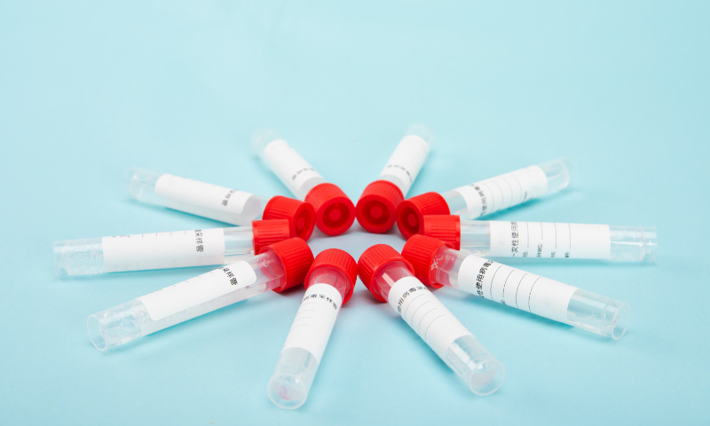 COVID-19 test Photo: VCG